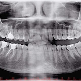 x-ray - radiology